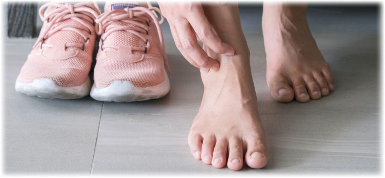 How to manage athlete’s foot