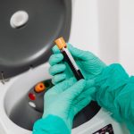 Why Your Gut Health Test Results Are Probably Wrong — And How to Fix It